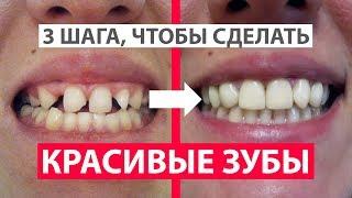 КАК СДЕЛАТЬ КРАСИВЫЕ ЗУБЫ? 3 ШАГА. БРЕКЕТЫ И РЕСТАВРАЦИЯ ЗУБОВ. ЦЕНЫ. ЗДОРОВАЯ ПОМОЩЬ #healthy_help