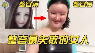 全世界整容最失敗的女人，整容前美若天仙，整容後變矽膠大媽丨明星觀察員丨整容丨網紅