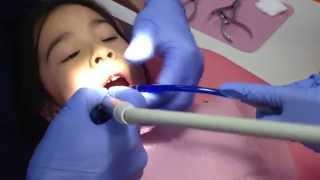 5 minutes Space-Maintainer By Dr. Idlibi, Kids Dental Care