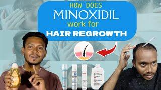 STOP  Hair Fail Using MINOXIDIL pro Plus, Is its used for life Time ⌛YES /NO