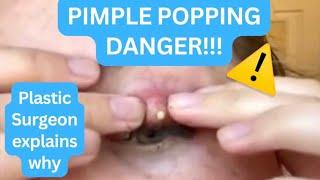 Pimple Popping Danger! Dr. A explains the risks