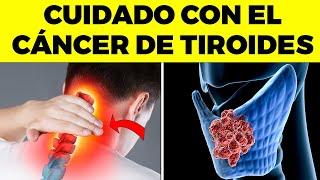 7 señales "raras"  de cáncer de tiroides que las pasan por alto