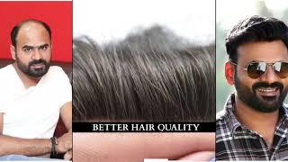 Hair Patch service | Natural Looking Hair | | Non-Surgical Hair Replacement