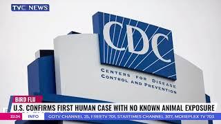 US Confirms First Human Case Of Bird Flu With No Known Animal Exposure