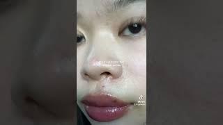Your skin is amazing!