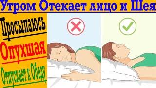 Утром отекает Лицо и Шея! Почему я ОПУХАЮ?!