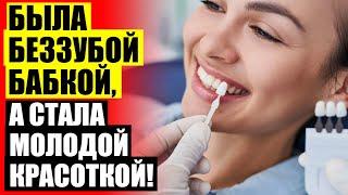  ВИНИРЫ ЗАКАЗАТЬ ПОЧТОЙ  DR SMILE ВИНИРЫ КАК УСТАНОВИТЬ