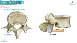 Anatomy of Lumbar vertebrae (Osteology) USMLE : Typical and Atypical lumbar vertebra