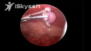 Laparoscopic Spay (Small dog 2 lbs) Dr. Jeffrey J Runge DVM, DACVS