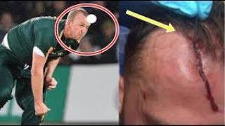 Luke Fletcher Hit In Head With Cricket Ball Birmingham vs Nottinghamshire!!