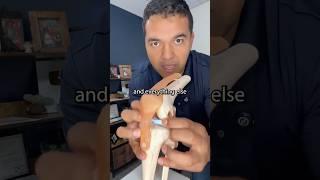 The real secret to avoid knee arthritis