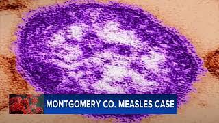 Measles confirmed in unvaccinated Montgomery County child; others may have been exposed