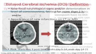 ICU Management of Subarachnoid Hemorrhage by Amedeo Merenda, MD