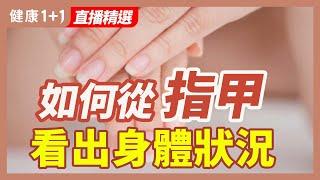 如何從指甲看出身體狀況 | 健康1+1 · 直播精選