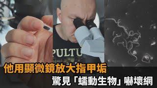 停止咬指甲！科學家用顯微鏡放大指甲垢　驚見「蠕動生物」網崩：要吐了－民視新聞