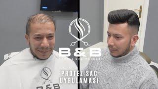 PROTEZ SAÇ UYGULAMASI -  KELLİĞE SON