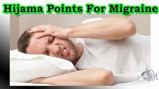 HIjama Points For Migraine