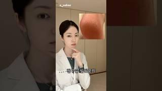 ‼️각질 대박 발뒤꿈치 해결법