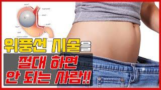 죽어도 식욕억제가 안되는 비만환자를 위한 간단한 시술, 그러나 수술만큼이나 효과가? (총정리 리뷰: 대상, 부작용)