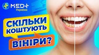 Білосніжна посмішка. Вініри: що варто знати перед реставрацією зубів?