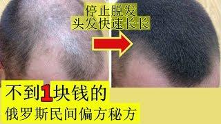 又便宜又有效治疗脱发的方法！【俄罗斯民间偏方秘方】