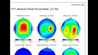 EEG Statistical analysis by NeuroGuide, Group Compare Mean | آنالیز آماری داده های EEG