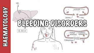 Approach to bleeding disorders - causes, pathophysiology and investigations