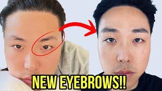 4 REASONS WHY I DIDN’T GET AN EYEBROW HAIR TRANSPLANT!