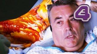 DIY Gone Wrong! - Man Nearly Loses Foot in Grinder Accident | Bizarre ER