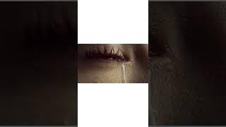 Menopause and Dry Eye: The Hormonal Connection