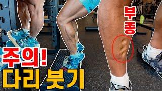 그대로 두면 큰일납니다! 다리 붓기(부종) 완화 종결 #산본헬스