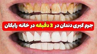 جرم گیری دندان درخانه با کمترین هزینه در 3 دقیقه