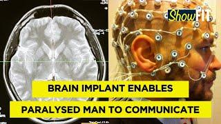 How Scientists Used A Brain Implant To Communicate With A Fully Paralyzed Patient