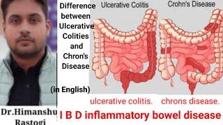 IBD INFLAMMATORY BOWEl DISEASE , DIFERECE BETWEEN ULCERATIVE COLITIS AND CHRONS DISEASE IN ENGLISH