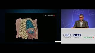 CAS One IR  current and future technology at CIRSE 2022 - Dr. Nadeem Shaida