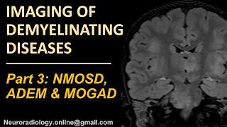 Imaging of demyelinating disorders (part 3) - NMOSD, MOGAD and ADEM