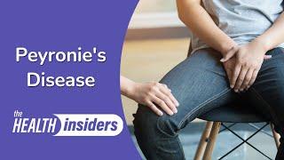 Peyronie's disease: Causes & Symptoms