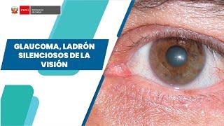 GLAUCOMA, LADRÓN SILENCIOSOS DE LA VISIÓN