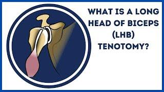 What is a Long Head of Biceps (LHB) Tenotomy?