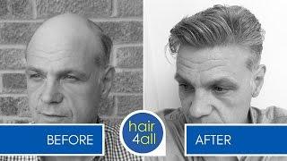 How to Exercise with a Non-Surgical Hair Replacement System for Men with Phil Osmond