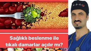 KALP HASTALARI NASIL BESLENMELİ ? - DR AHMET KARABULUT