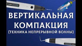 Вертикальная компакция методика непрерывной волны. Пломбировка жидкой гуттаперчей GuttaFill Guttaest