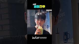 남자 눈성형 이 영상으로 종결 ! #무쌍눈매교정 #무쌍성형 #무쌍수술 #무쌍 #남자앞트임 #앞트임 #앞트임수술 #앞트임전후 #무쌍수술전후 #인스타성형외과 #남자성형