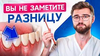 Чем заменить передние зубы после удаления? ТОП 4 способа