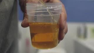 How to peeing bottle for check urinating