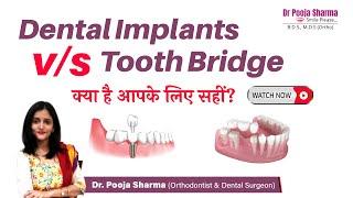 Advantages & Disadvantages Of Dental Implants VS Tooth Bridge - Dr Pooja Sharma