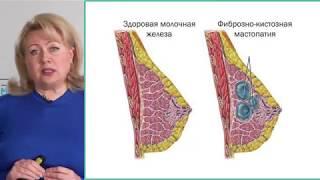 Признаки рака груди. Как не пропустить рак молочной железы? Симптомы рака молочных желез.