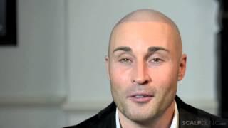 David Richards Dreamboys undergoes Scalp Micropigmentation at Scalp Clinic