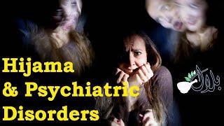 Hijama & Psychiatric Disorder explained by Dr Bilal