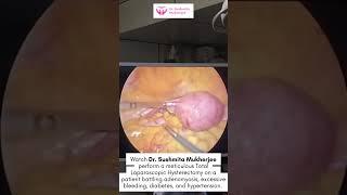 Expert Care for Complex Cases Total Laparoscopic Hysterectomy by Dr  Sushmita Mukherjee